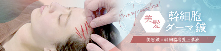 美髪幹細胞ダーマ鍼