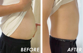 BEFORE/AFTER