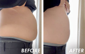 BEFORE/AFTER
