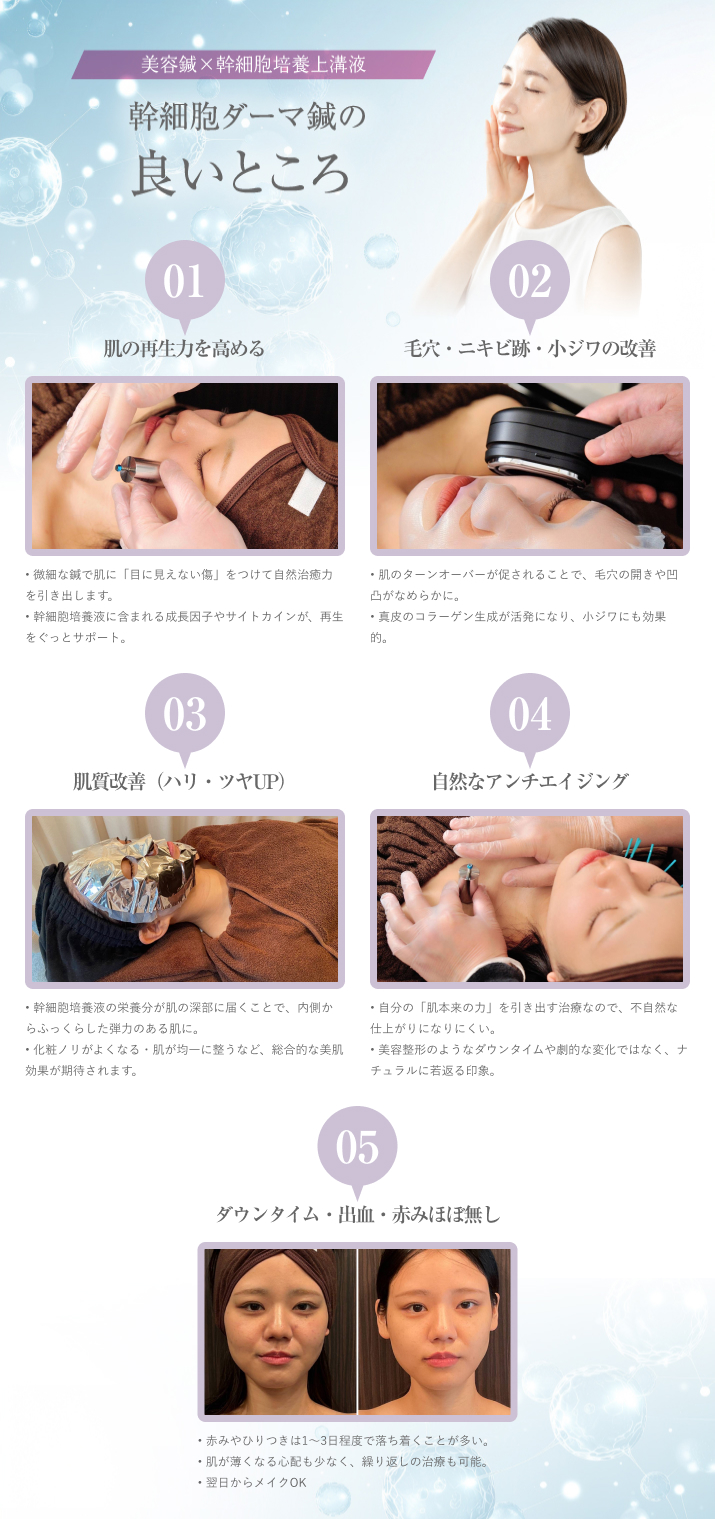 幹細胞ダーマ鍼の良いところ
