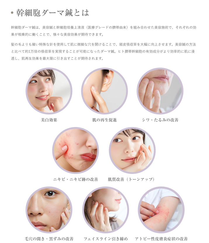 幹細胞ダーマ鍼とは
