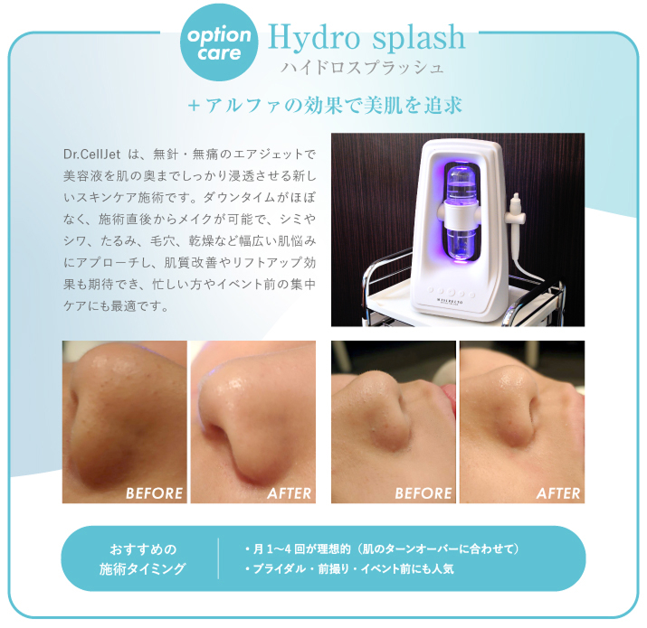 ハイドロスプラッシュ