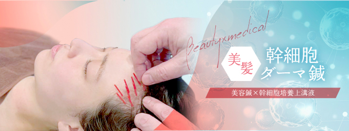 美髪幹細胞ダーマ鍼